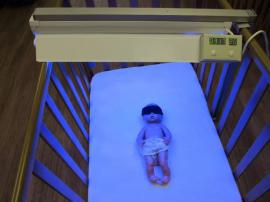 Фотолампа для лечения желтушки у новорожденных Philips